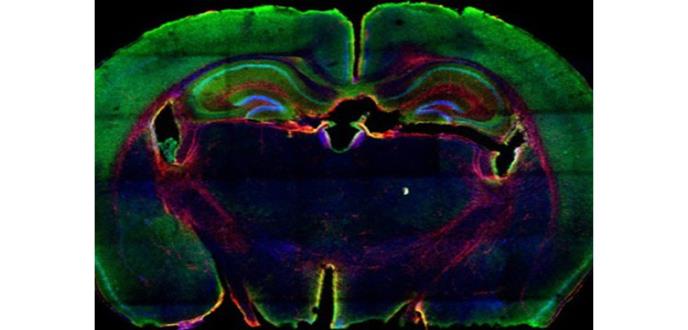 Diseñan un modelo tumoral que acelera el tratamiento del cáncer