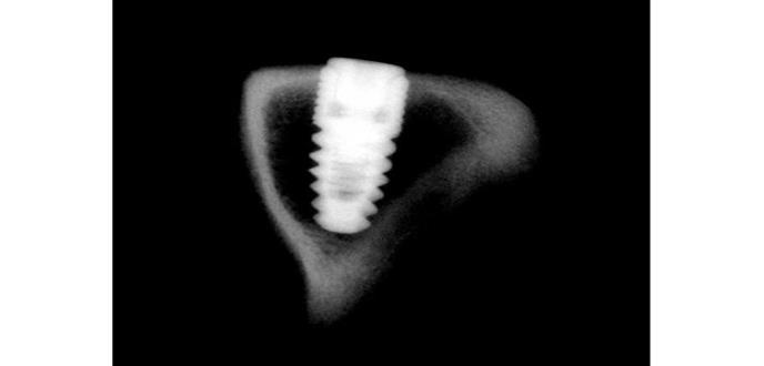 El deporte que te hace ingerir las bacterias más resistentes a los antibióticos