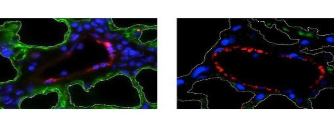 Crean la estructura de un pulmón y logran que funcione
