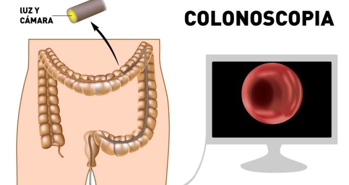 Alimentación: clave en el tratamiento de los cánceres  digestivos
