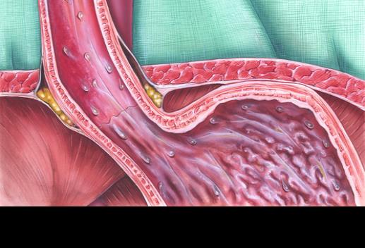 Estudio abre la puerta hacia el uso de terapias específicas para cada subtipo de cáncer de esófago