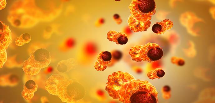 El cáncer metastásico se disemina con la fructosa