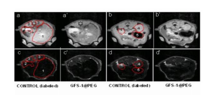 La microbiota intestinal como diana terapéutica para combatir la obesidad