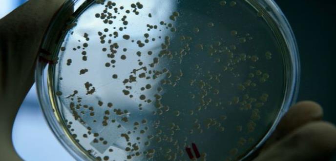 Por qué es tan difícil desarrollar nuevos antibióticos