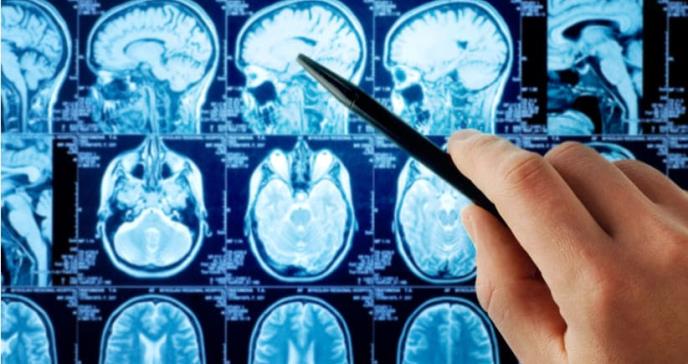 Alteraciones neurológicas: efectos adicionales del cáncer nefrourológico