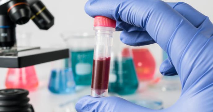 Nuevos análisis de sangre para diagnóstico de coronavirus