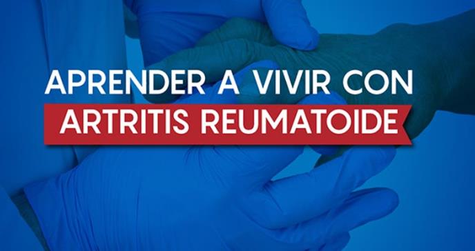 Aprender a vivir con artritis reumatoide