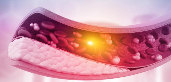 Manejo de hiperlipidemia en el paciente diabético