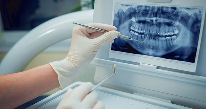 Manejo de urgencias dentales para adultos mayores en puerto rico durante COVID-19: reporte de casos