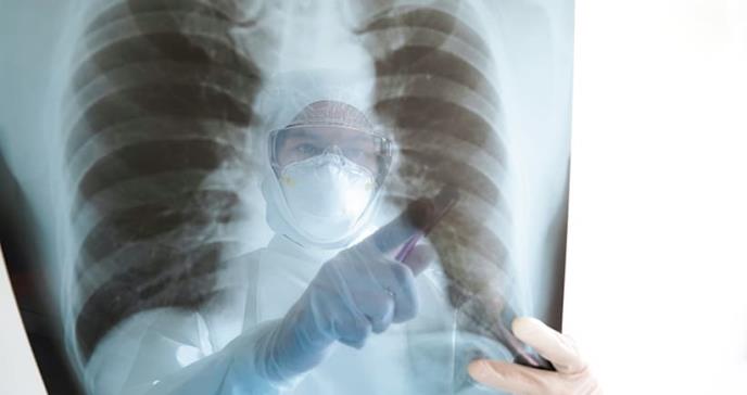Actualización del uso de imágenes durante la pandemia de COVID-19