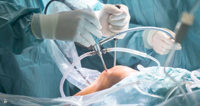 Cirugías y COVID-19: antiinflamatorios y relajantes musculares para el manejo del dolor
