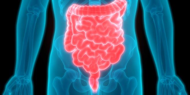 Biosimilar, un medicamento para tratar pacientes con enfermedad de Crohn y Colitis Ulcerosa Biosimilar, un medicamento para tratar pacientes con enfermedad de Crohn y Colitis Ulcerosa