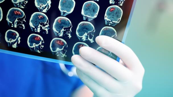 VPH: factor de riesgo en el desarrollo de diversos tipos de cáncer VPH: factor de riesgo en el desarrollo de diversos tipos de cáncer