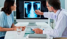 Cómo lograr una buena rehabilitación respiratoria en pacientes con cáncer de pulmón