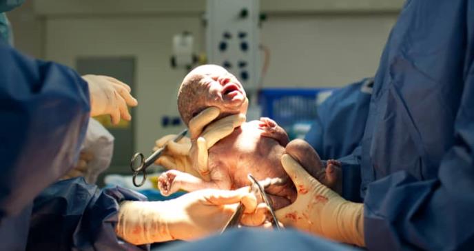 La cesárea, factor de riesgo para el desarrollo psicológico en gemelos