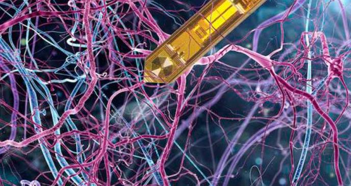 Científicos desarrollan el primer detector de resonancia magnética implantable