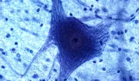 Científicos descubren uno de los mecanismos físicos de la adicción a la cocaína