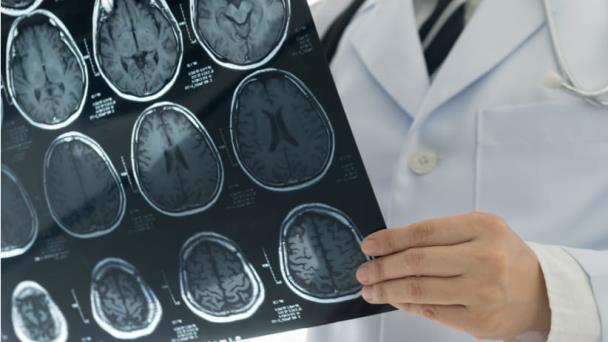 Cómo identificar en qué momento del día el cerebro es más eficiente