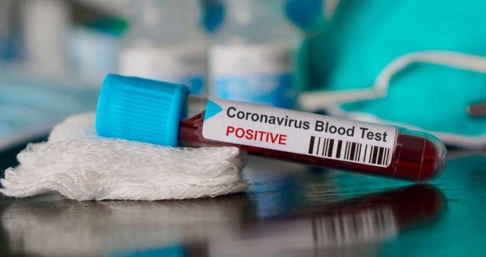 Confirman que un brasileño es el primer infectado por coronavirus en América Latina