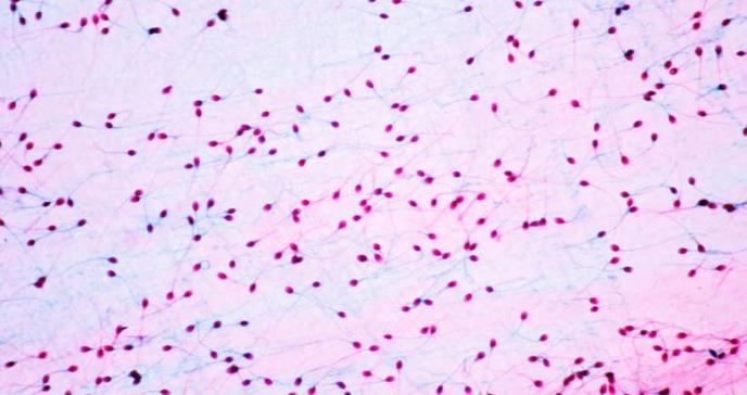 Coronavirus podría generar infertilidad masculina
