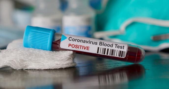 Estados Unidos confirma cinco casos de coronavirus de Wuhan