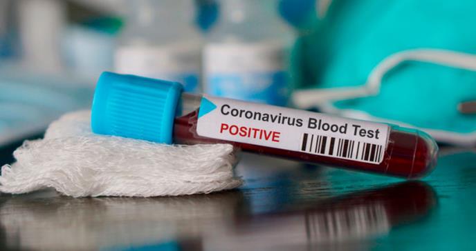 Departamento de Salud no reporta muertes adicionales por COVID-19 en la isla