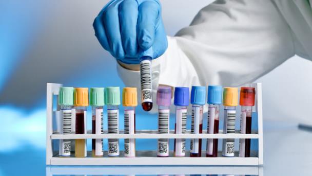 Departamento de Salud ordenó 200 mil rapid kits para detectar Covid-19 Departamento de Salud ordenó 200 mil rapid kits para detectar Covid-19
