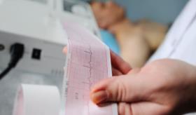 ¿Cómo detectar a tiempo la fibrilación atrial? Una afección asintomática de riesgo y usualmente silente