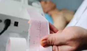 ¿Cómo detectar a tiempo la fibrilación atrial? Una afección asintomática de riesgo y usualmente silente