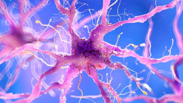Descubren mayor posibilidad de infartos e ictus antes de un diagnóstico de cáncer Descubren mayor posibilidad de infartos e ictus antes de un diagnóstico de cáncer