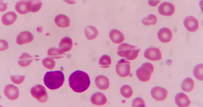 Detectan ocho tipos de cáncer en sangre antes de que se extiendan