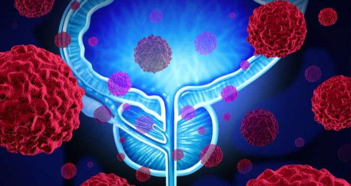 Identifican posible diana terapéutica para el cáncer de próstata y la enfermedad de Kennedy