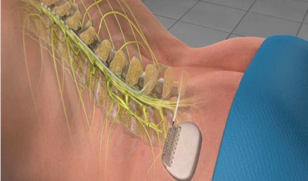 Diez terapias médicas futuristas que llegan en 2020 para quedarse