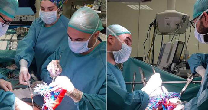 Diseñan modelos 3D para operar tumores en el hígado de manera óptima