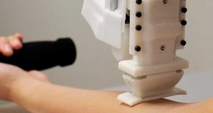 Diseñan robot que analiza muestras de sangre en venas de difícil acceso