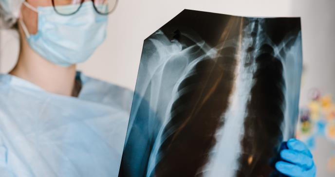Utilidad de la ecografía pulmonar en pacientes con sospecha de COVID-19