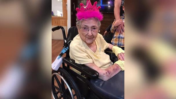 El caso único de la mujer que vivió 99 años con los órganos invertidos sin saberlo El caso único de la mujer que vivió 99 años con los órganos invertidos sin saberlo