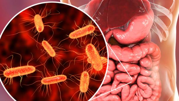 El microbioma de una persona cambia al emigrar a EEUU El microbioma de una persona cambia al emigrar a EEUU