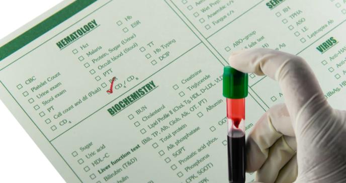 Necesaria la prueba CD4 para reducir el VIH en países de ingresos bajos: expertos