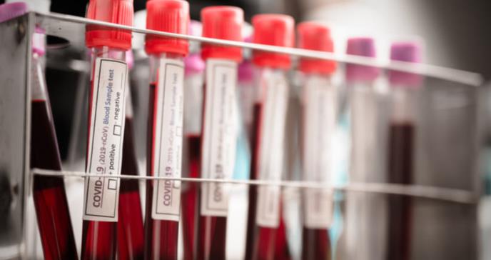 Resultados erróneos de test COVID-19 dan falsa seguridad a médicos y pacientes
