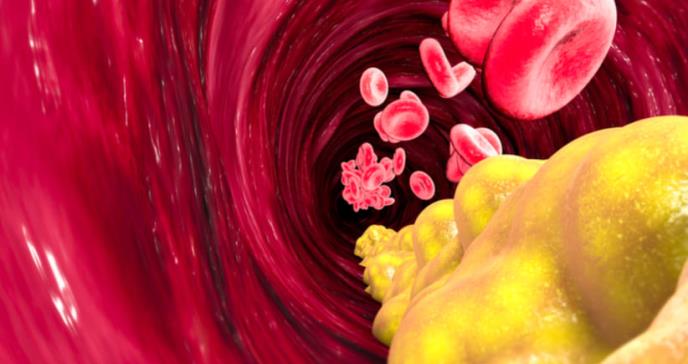 Identificada una proteína que cuadruplica el riesgo cardiovascular