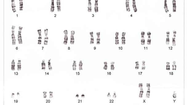 Identifican alteraciones cromosómicas asociadas a la disforia de género Identifican alteraciones cromosómicas asociadas a la disforia de género