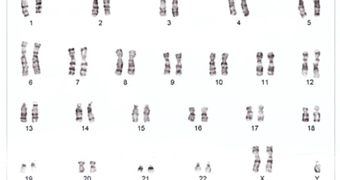 Identifican alteraciones cromosómicas asociadas a la disforia de género