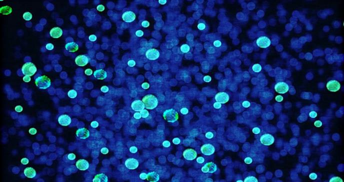 Identifican bacterias intestinales que podrían evitar la obesidad en las personas