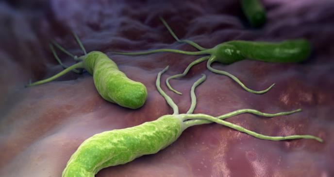 Identifican una mucosa que oculta el cáncer de estómago