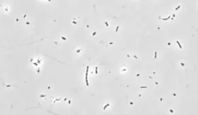 Prebióticos y probióticos para reducir los síntomas del lupus