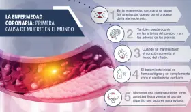 La enfermedad coronaria: primera causa de muerte en el mundo