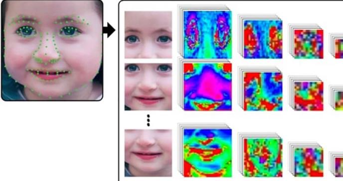 Inteligencia artificial, nueva aliada para identificar síndromes genéticos