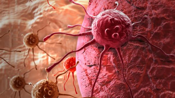 La novedosa terapia para luchar contra el cáncer La novedosa terapia para luchar contra el cáncer