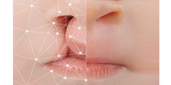 Tecnología 3D mejora la cirugía de labio leporino y paladar hendido Tecnología 3D mejora la cirugía de labio leporino y paladar hendido